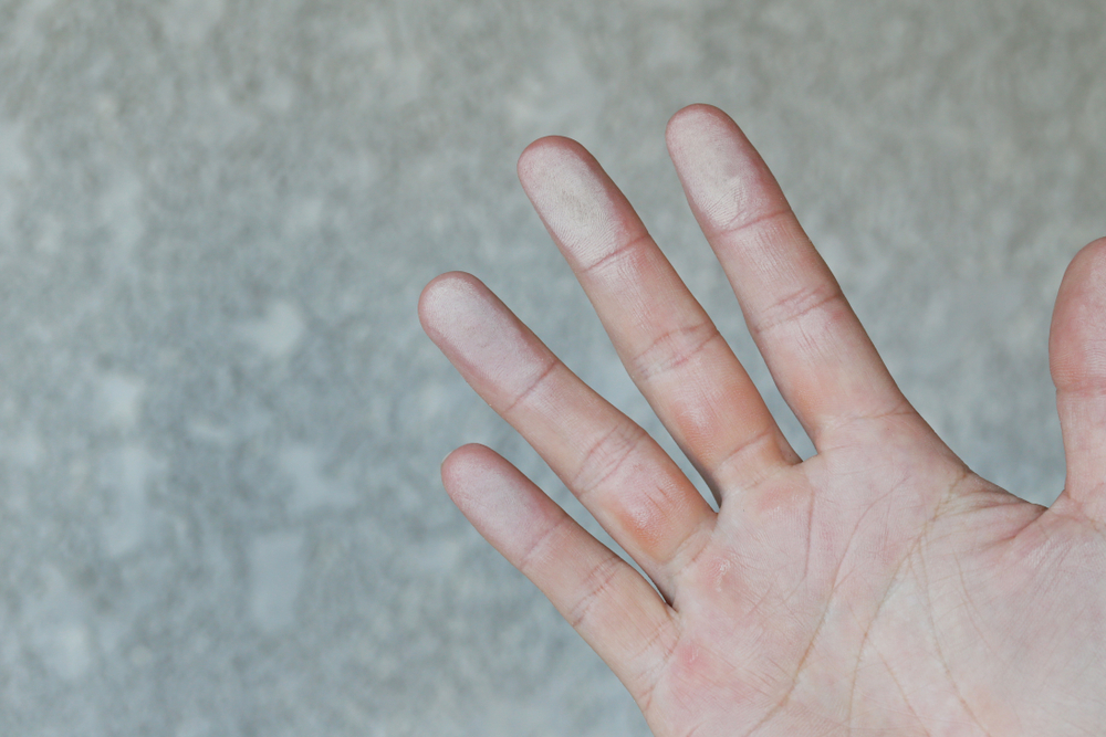 Bề mặt sơn bị phấn hóa